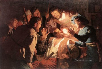 Gerard van Honthorst Painting - The Dentist nighttime candlelit Gerard van Honthorst